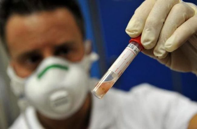 Meningite Lecco lieve miglioramento per la donna ricoverata