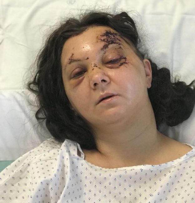 Picchiata a sangue dal compagno chiede aiuto