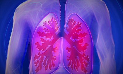 Tubercolosi polmonare, due casi correlati a Saronno