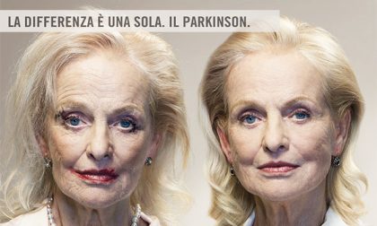 AAA gemelli cercansi per poter curare il Parkinson