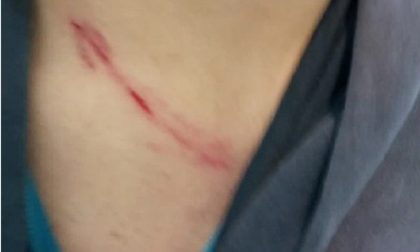 Picchiato da un mendicante a Lurate: "Situazione insostenibile"