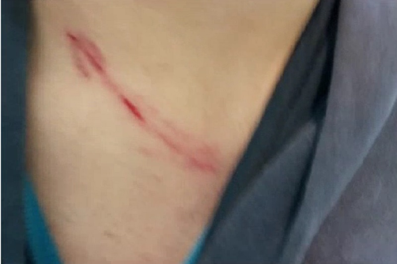 Picchiato da un mendicante a Lurate: “Situazione insostenibile”