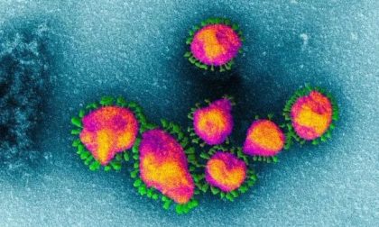 Albavilla, la minoranza avanza proposte per fronteggiare l'emergenza Coronavirus