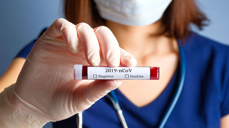 Coronavirus in Lombardia: 3.941 positivi di cui 299 comaschi