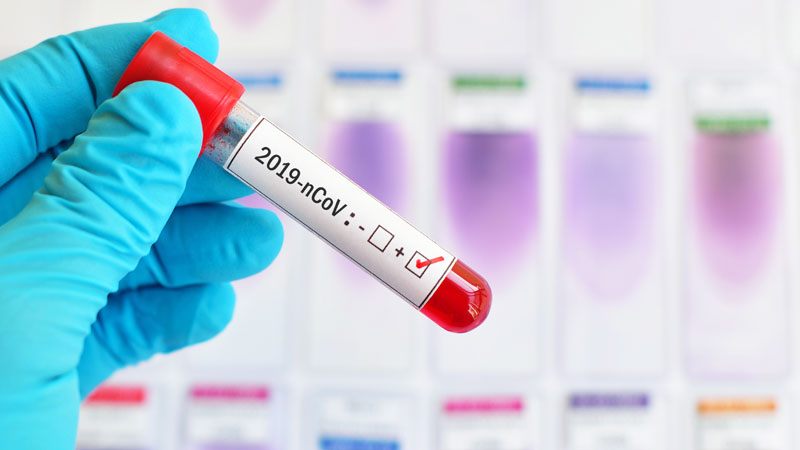 Emergenza Coronavirus, la situazione nel Comasco: altri tre decessi a Cantù, uno ad Appiano e a Tavernerio