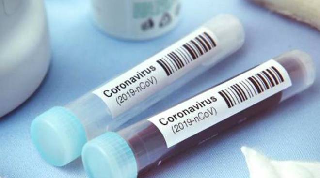 Coronavirus in Lombardia: 3.099 casi in Regione