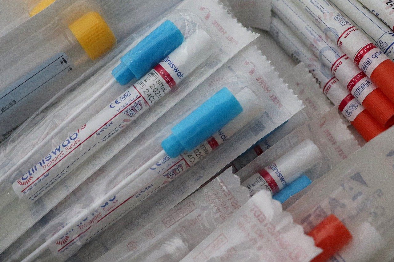 Coronavirus in Lombardia: 255 nuovi casi in Regione, +7 nel Comasco