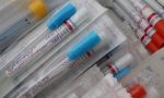 Coronavirus in Lombardia: 1.721 contagi a fronte di oltre 11mila tamponi