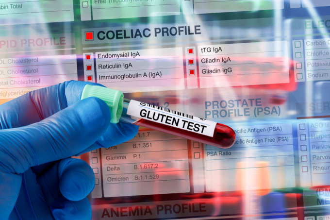 Nuova Campagna di prevenzione presso i Punti Prelievo Glab: un semplice prelievo di sangue è il primo passo per la diagnosi di celiachia
