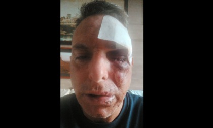 L'ex paninaro "Nico" picchiato a sangue in strada: "Avrebbe potuto ammazzarmi"