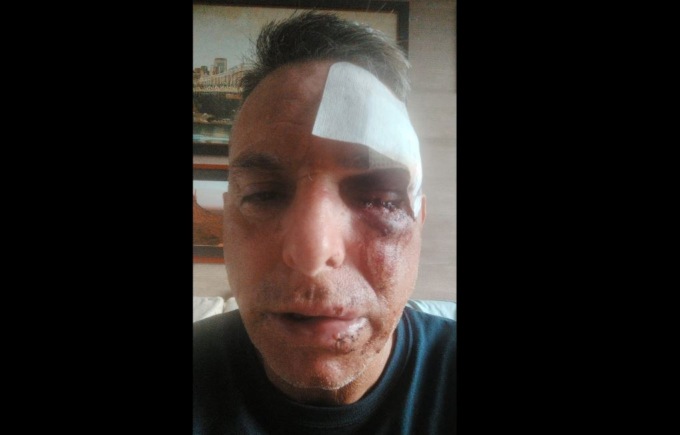 L’ex paninaro “Nico” picchiato a sangue in strada: “Avrebbe potuto ammazzarmi”