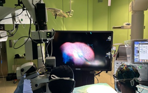 Oculistica: introdotto un sistema operatorio di visualizzazione tridimensionale