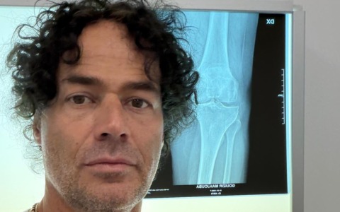 Protesi al ginocchio: al COF Lanzo Hospital debutta la tecnologia robotica ROSA